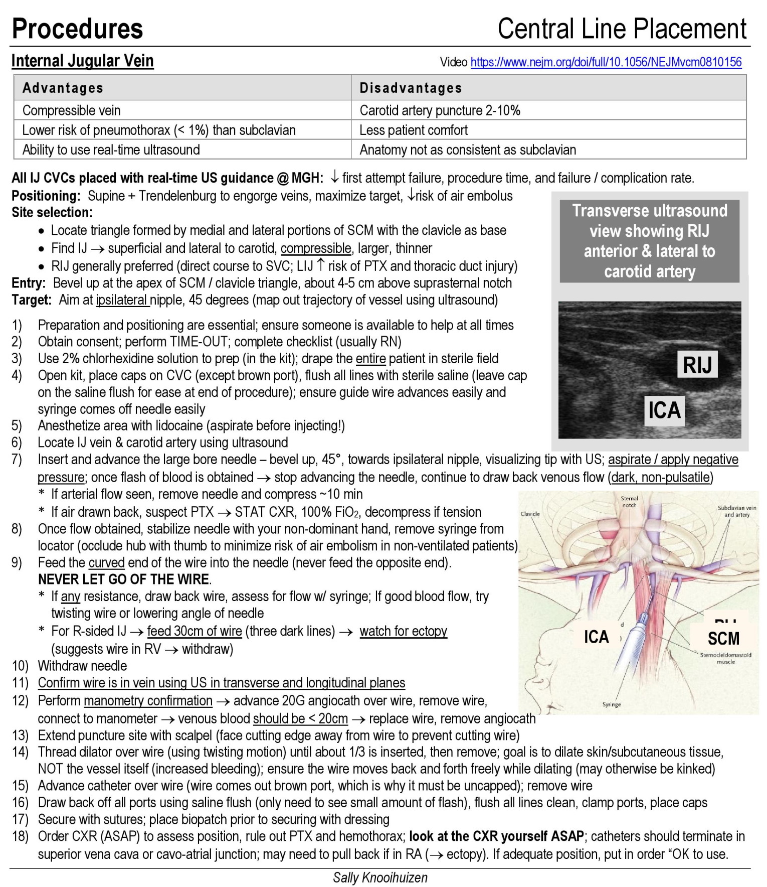 Procguide Internal Jugular Central Line 8B5