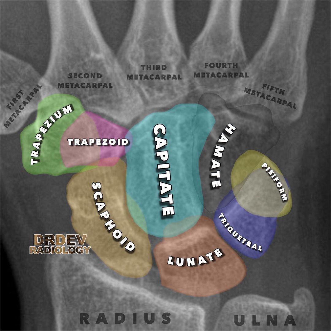 Carpal Bones Labeled