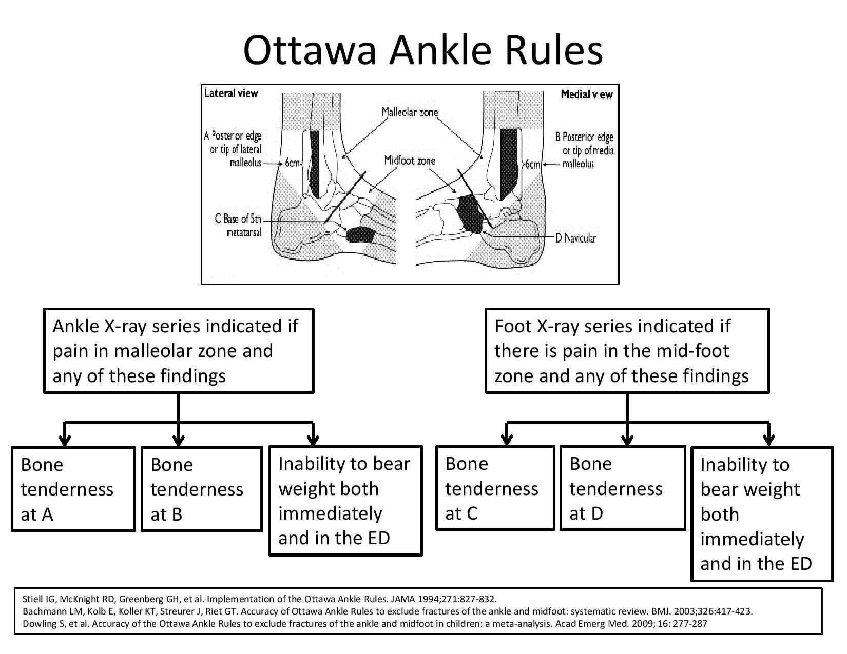 Ottawa Foot Ankle Rules Diagnosis Peds XRay Ottawa GrepMed Ottawa Foot Ankle Rules Diagnosis Peds XRay Ottawa GrepMed