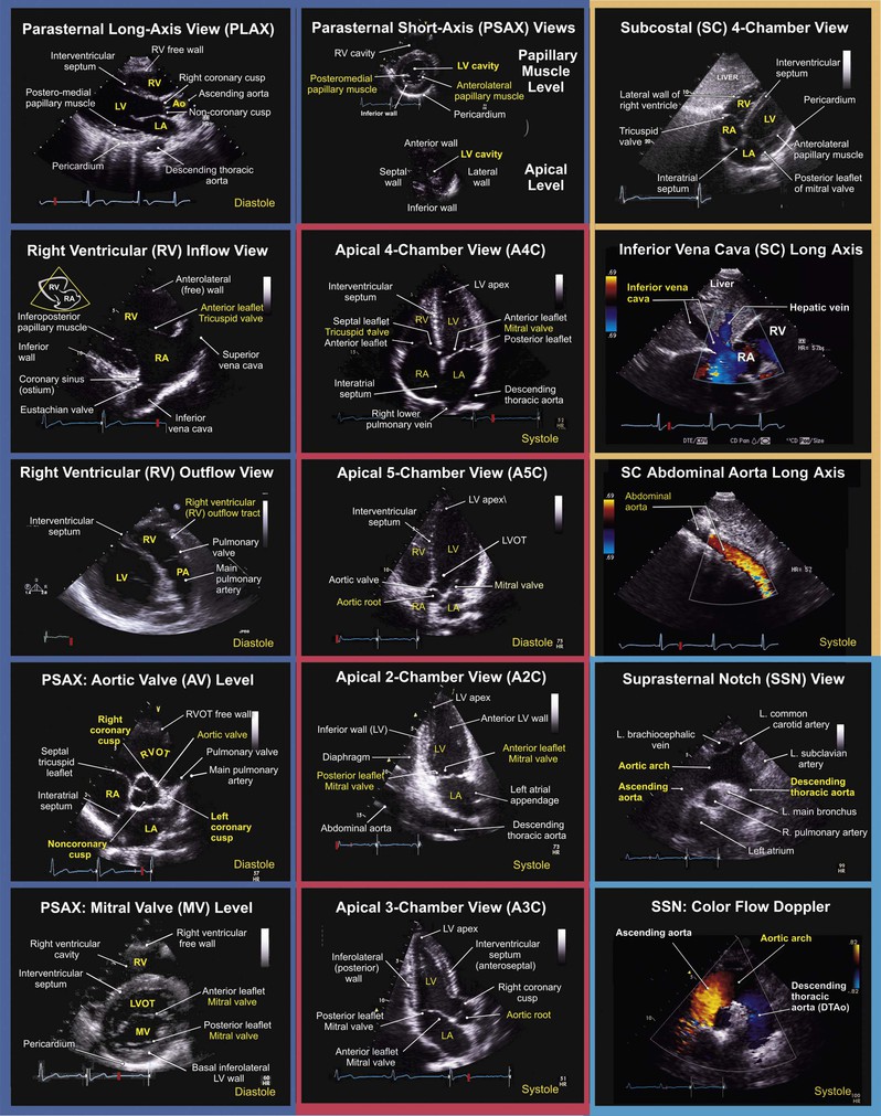 POCUS Echocardiography - Table of Cardiac Views and Windows