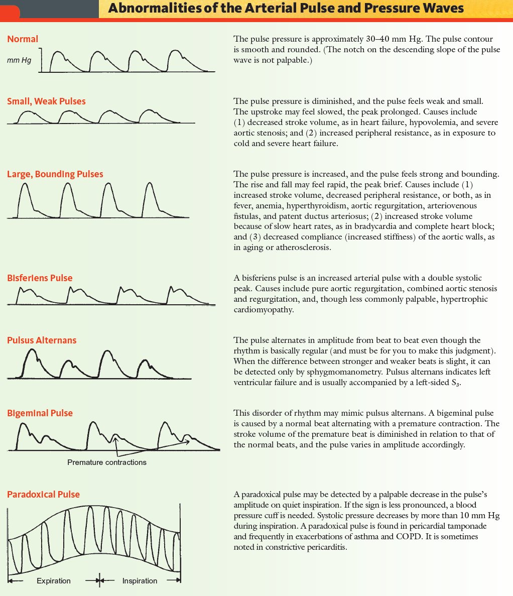 Pulsus Paradoxus Vs Pulsus Alternans