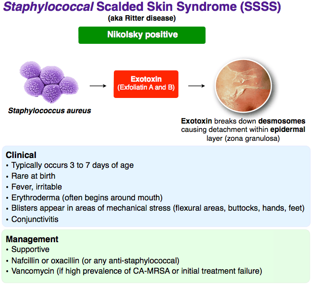 Scalded Skin Syndrome Staphylococcal Scalded Skin